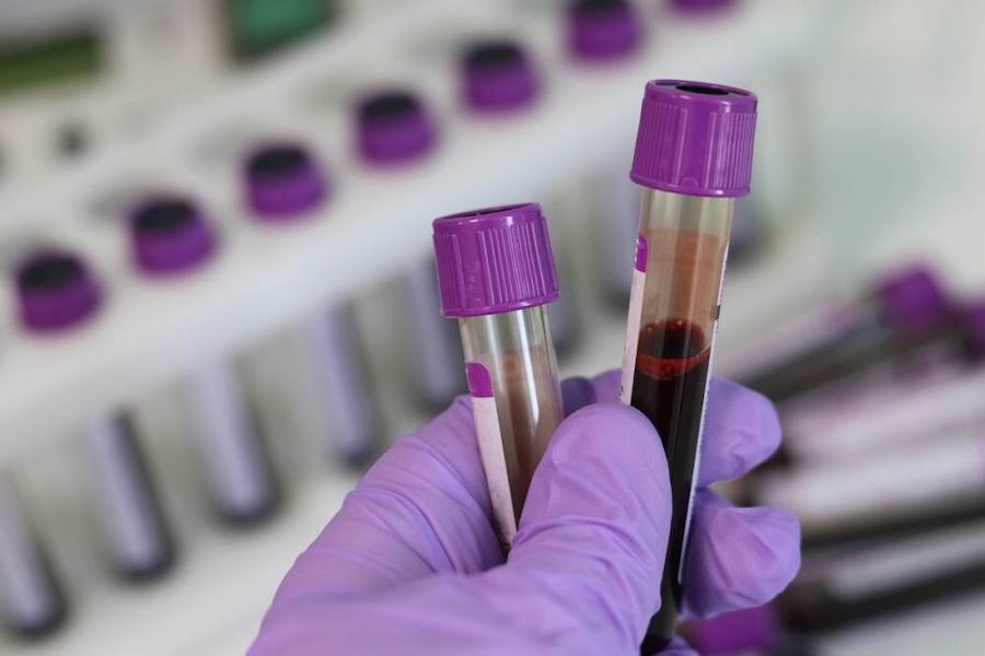 Біохімічний аналіз крові