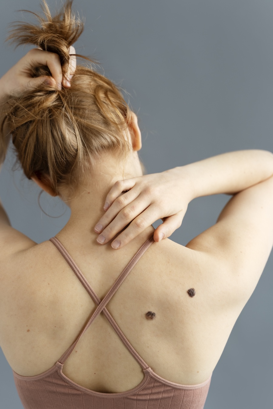 2-й Європейський дерматоонкологічний конгрес 2025